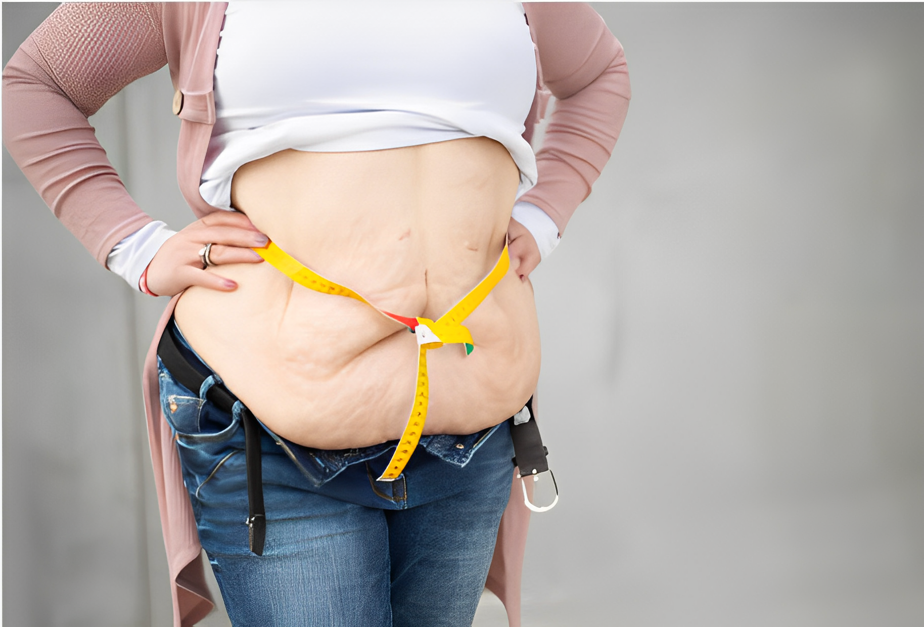 The Role of Bariatric Surgery in Reducing the Global Obesity Epidemic