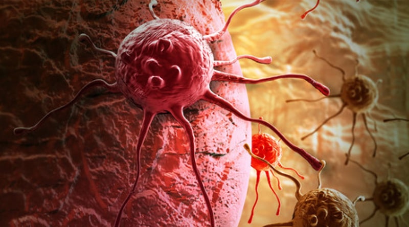 Benign or Malignant Skin and Soft Tissue Tumors