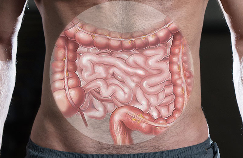 Laparoscopic Large Bowel Surgery