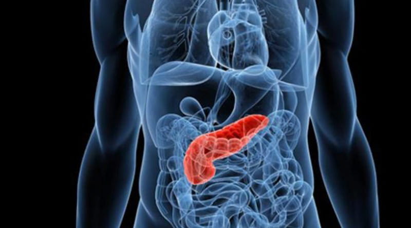 Pancreatitis